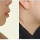 이.스마일치과교정과치과의원 이미지