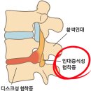 365경희길음한의원 | 허리 협착증 치료! 길음동 365경희길음한의원