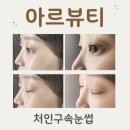 채니뷰티 | 용인 처인구 속눈썹펌으로 유명한 아르뷰티에서 3Step 클리닉펌 받은 상세 후기👀♥️