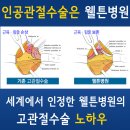 고관절골절 수술후 고관절통증 발생 :: 고관절 인공관절수술 로 치료합니다. 이미지