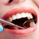 에이스덴탈치과기공소 | 덴탈맥스 지르코니아, 치과보철의 새로운 표준을 말하다!