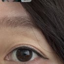 샛별안과의원 이미지