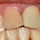 인성치과기공소 이미지