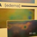 모델라지
