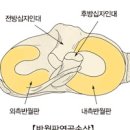 무릎 구부릴때 안쪽 앞쪽 뒤쪽 통증 원인 이미지