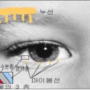 안구건조증[dry eye syndrome] 이미지