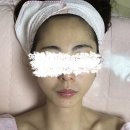 에스테라피 이미지