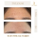 더조각테라피 이미지