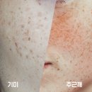 대연류피부과 이미지