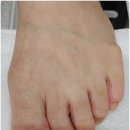 구암약국 | 대전 구암역 무좀발톱 전문샵 만족 후기 열개의손가락 닥터아이티엔 대전유성구점