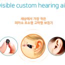 스타키보청기의정부센터 이미지