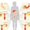 췌장암 전조증상 원인과 종류 등통증 위치 예방법 이미지