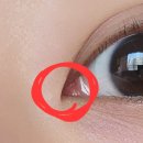 참밝은안과의원 이미지