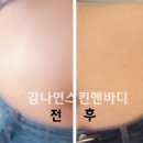 강나연 스킨앤바디