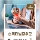 삼성연합통증의학과의원 | 시지 통증의학과 손목터널증후군 초기 증상, 대부분 이 신호를 놓칩니다