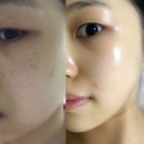 스킨바