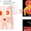 [필리핀생활] 그동안 돌봐 드린 교민환자들 Top 5 질병입니다. 이미지