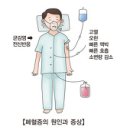 패혈증의 증상 이미지