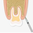 양재영치과의원 | 수원사랑니 전문치과, 하루 30개 발치하는 의사가 말하는 2가지 팁
