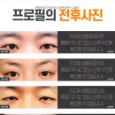 프로필성형외과의원 이미지
