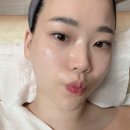 태평양뷰티라인 | 상동 피부관리샵 뷰티포톤피아 하이푸 V라인 관리 + 여드름 관리 받고 온 후기
