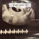 햇빛동물병원 | 6,7w) 임신초기 피고임 연근가루, 입덧의 연속 침덧 토덧 체덧 양치덧, 햇빛병원 입덧수액 가격