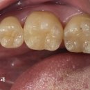 고운 치과기공소 이미지