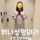 꿈꾸는성형외과의원 | 강남 워나성형외과의원 상안검 절개 쌍수 쌍꺼풀 인아웃라인 수술 전/후 당일 후기(ft.붓기)