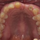 블루치과기공소 이미지