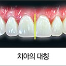 스마일라인치과기공소 이미지