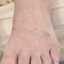 닥터아이티엔발톱깎이 이미지