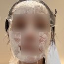 같이 | 리쥬란 쥬베룩같이 받은 후기, 리쥬베룩4cc, 공장형피부과