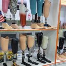 의족보조기센터 이미지