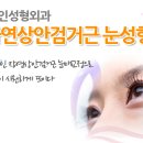 아인성형외과 이미지