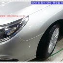 덴트렉스 이미지