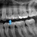 서울뿌리깊은치과의원 이미지