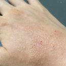 (유)동일약품 | 리도맥스 연고 0.3 효과 부작용 피부 관리 후기