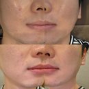 첨단메디칼(주) | 센텀남자피부관리 센텀에스테틱 에스테틱,무결