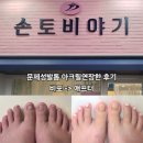 토비네일 - 성남시 수정구 위례광장로 12 | 부산대 네일 손토비야기에서 문제성발톱 아크릴연장한 후기.