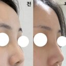 전세정독일피부과의원 | 예비신랑과 함께 공장형 피부과 코필러 후기(대형 피부과 잘 고르는 법)