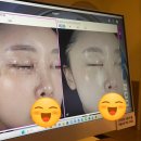 가츠원 | [양천구 피부관리] H피부관리 맞춤형 피부 진단 VVS관리 까지 최고였던 신월동 H에스테틱