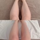 리턴에스테틱토탈뷰티 | 구리 스킨온 에스테틱 l 하체관리 후기 l 구리 토탈뷰티샵