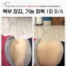 SNPE바른자세척추운동교실-B | 사당 바른몸바디프로젝트 "허리 통증, 허리 디스크여도 운동으로 정말 좋아질 수 있을까요?"