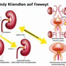 발병률 세계 1위 ‘신부전증’ – 5가지 원인 및 초기 증상 체크리스트표와 9가지 생활수칙 이미지