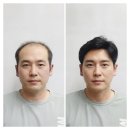 우정동미용실&위그(wig) | 산본가발 맞춤 후기: 티 안 나고 자연스러워서 놀란 내돈내산 방문기