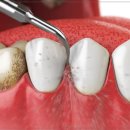 센트럴뉴욕치과의원 이미지