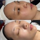 서울대입구왁싱 블랙여우 왁싱&amp;속눈썹 만족스러웠던 풀페이스 피부관리 후기