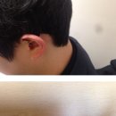 오티콘보청기동작점