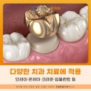 연동치과기공소 이미지