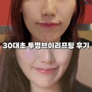 라포약국 | 30대 초반 땅콩형 얼굴 신사역성형외과 라포엘실리프팅 받고 왔어요!!
